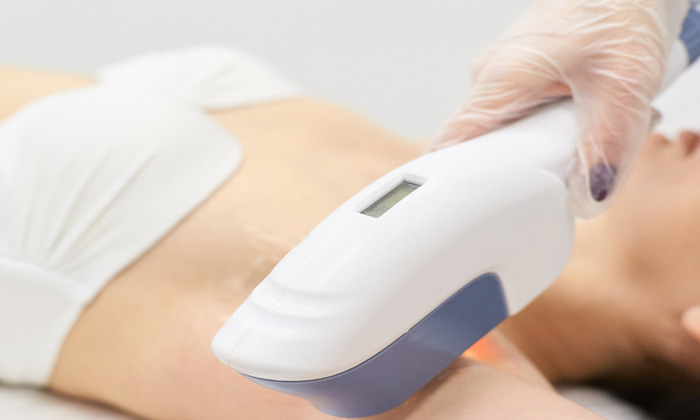 لیزر موهای زائد در اکسیر شهرک غرب